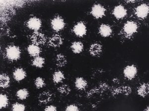 Vírus Hepatite E