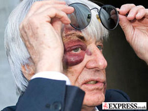 De olho roxo, Ecclestone diz ter - Esportes - R7.com