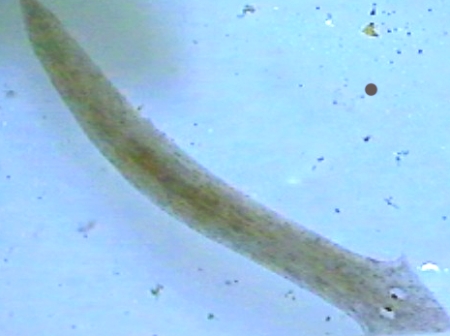 http://i1.r7.com/data/files/2C92/94A4/2819/B567/0128/2858/19D9/01D7/Planaria-g-20100422.jpg