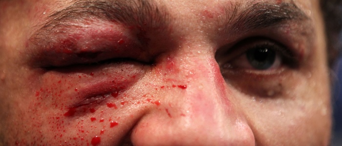 koschek-ufc-700.jpg