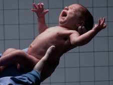 Bebê prematuro corre mais risco de problemas mentais