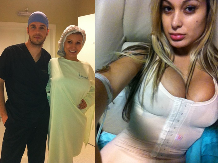 Ex-latinete posa de cinta modeladora depois da lipo. Veja os ...