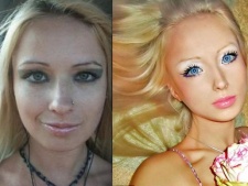 Veja fotos da barbie humana antes e depois de várias plásticas!