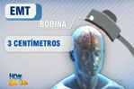 Nova técnica pode ajudar no tratamento da depressão