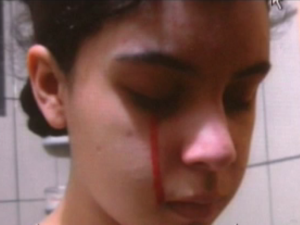 Balan&ccedil;o Geral DF: Adolescente de 14 anos chora sangue - Distrito ...