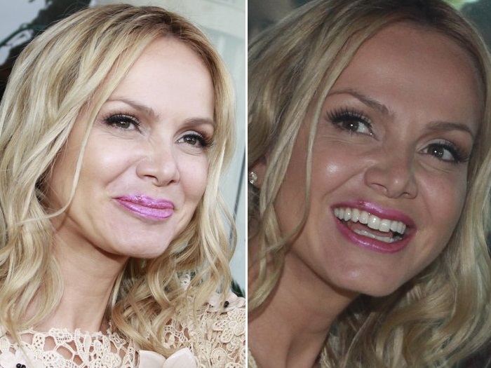 Ela n&atilde;o &eacute; t&atilde;o linda assim! Eliana sai de casa com machucado nos ...