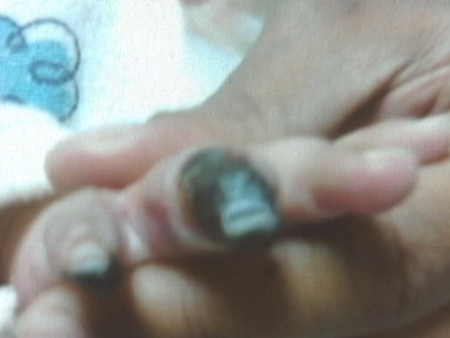 dedo
