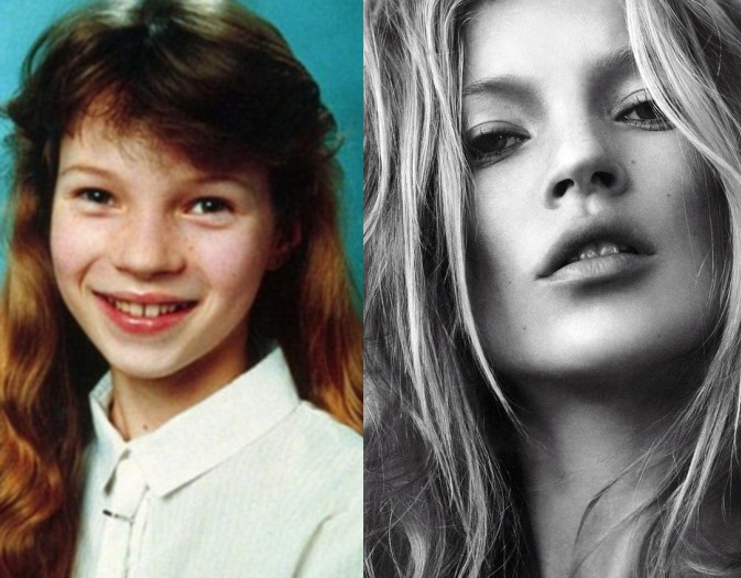 confira como eram os famosos quando adolescentes