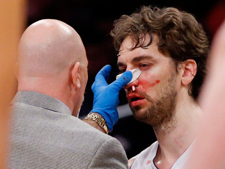 Pau-Gasol-sangrando-450x338-reu-070113