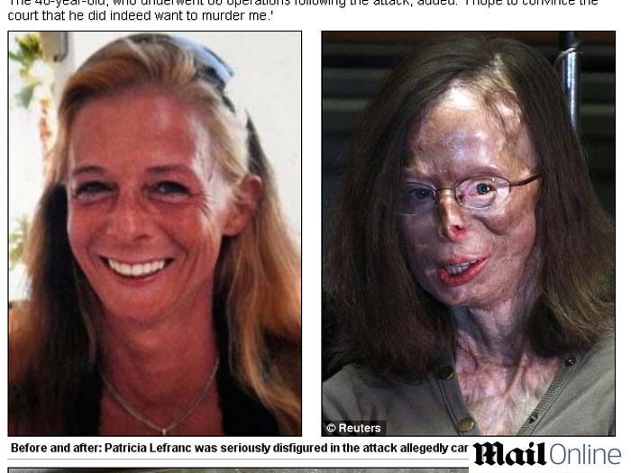 bélgica, patricia lefranc, antes, depois, daily, 700