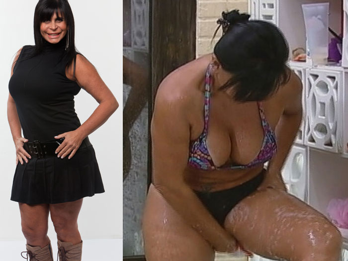Gretchen diz que "perdeu a conta" de quantas pl&aacute;sticas fez e d&aacute; ...