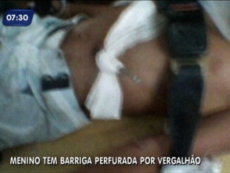 Crian&ccedil;a ferida por vergalh&atilde;o na barriga deixa hospital - Rio de ...