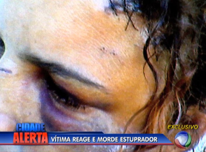 Violentada, prostituta reage e morde &oacute;rg&atilde;o sexual de estuprador ...