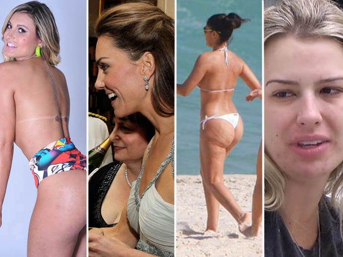 Elas t&ecirc;m espinhas e celulites! Veja como as famosas s&atilde;o de ...