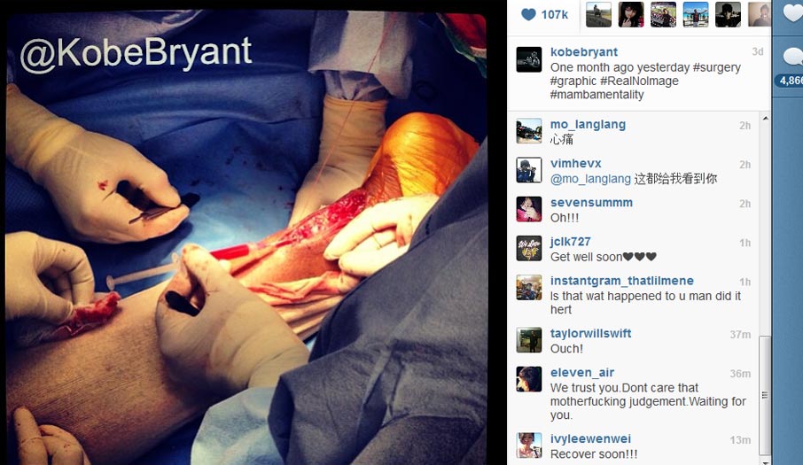 Kobe Bryant posta foto impressionante de sua cirurgia - Esportes ...