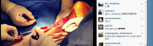 Reprodução/Instagram Kobe Bryant posta foto impressionante de sua cirurgia